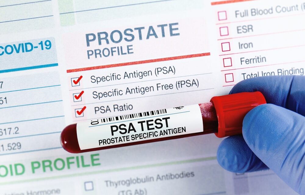 California Men Tend to Ignore Prostate Exam