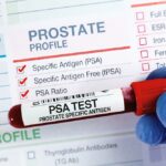 California Men Tend to Ignore Prostate Exam